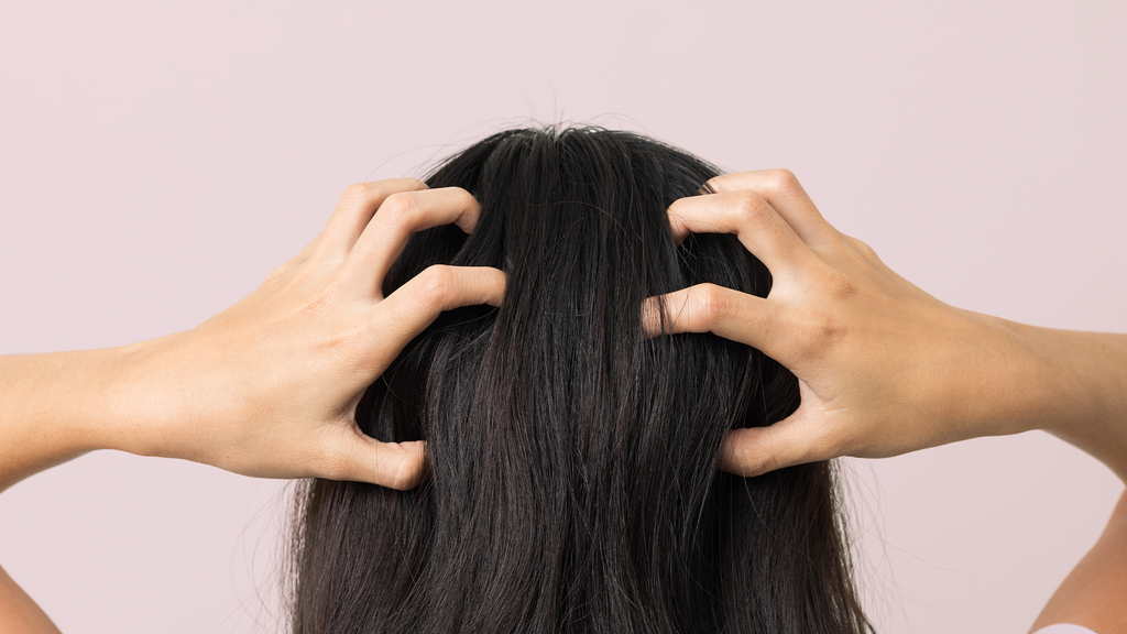 Itchy Scalp? Here’s What You Need to Do